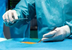 Catheter manufacturers